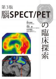 第3版 腦SPECT/PETの臨床探索